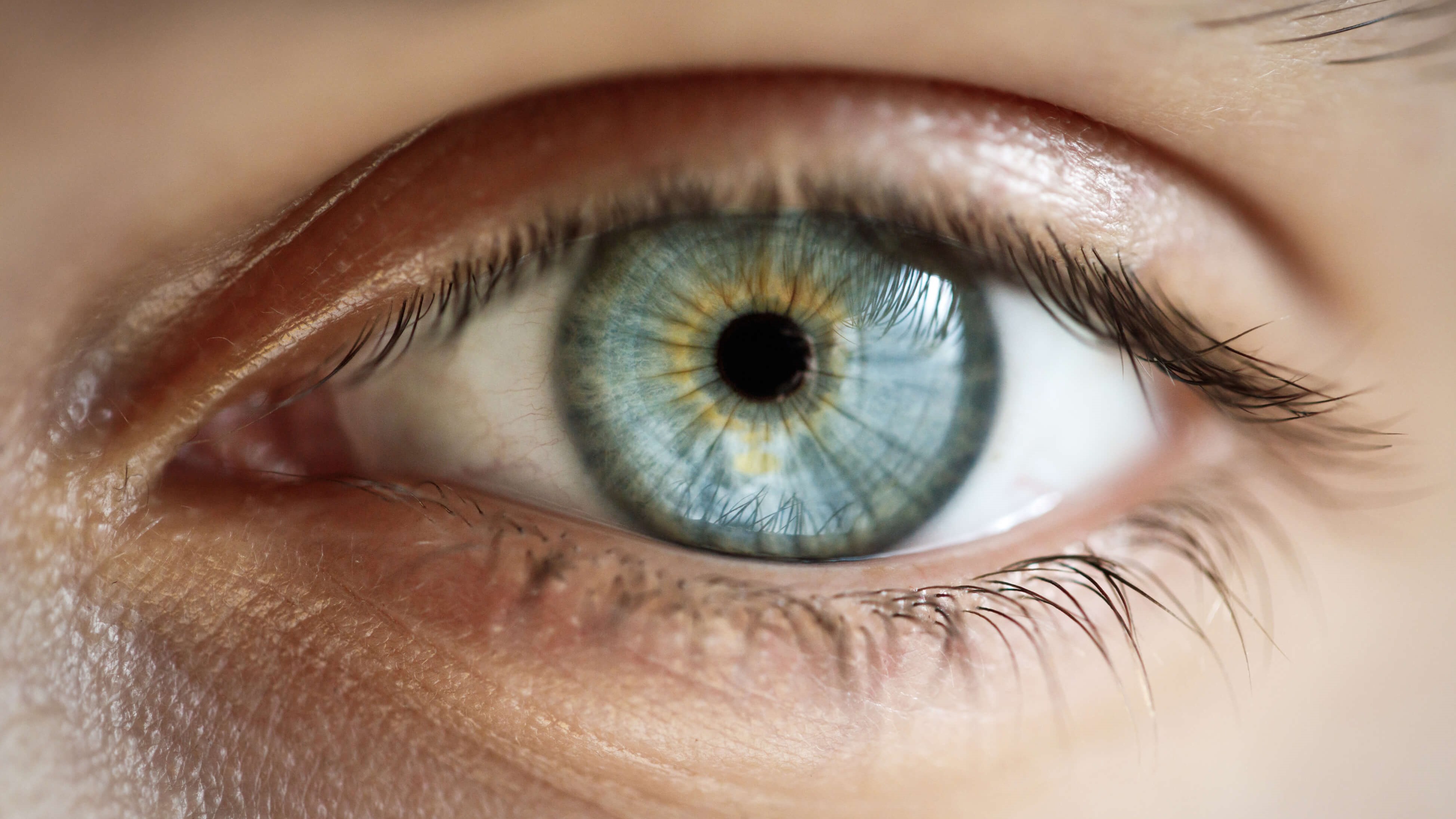 Lasik